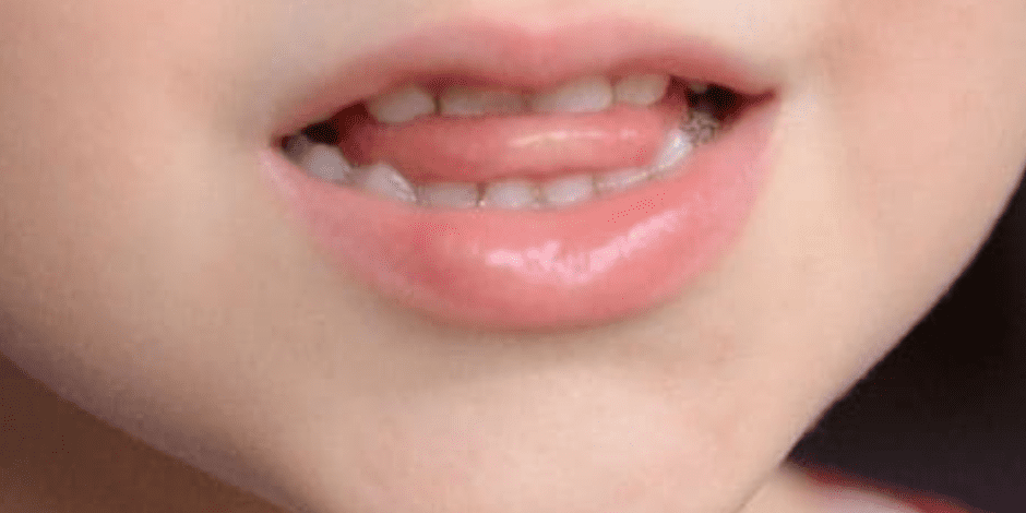 Blogartikel: Lispeln loswerden - Tipps und Übungen für Kinder und Erwachsene